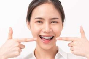 Como cuidar los dientes con una ortodoncia