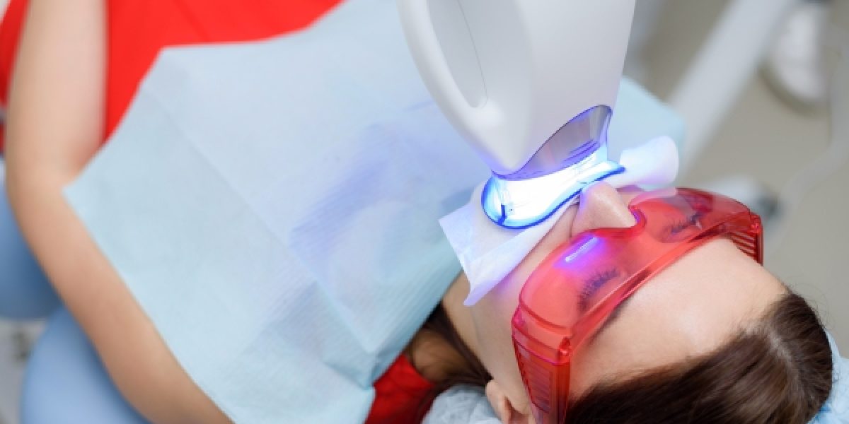 ¿Por qué debería blanquearme los dientes un dentista profesional?